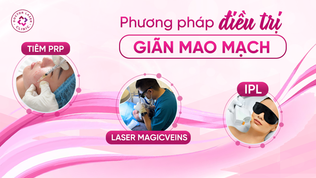 Phương pháp điều trị giãn mao mạch Laser Magicveins