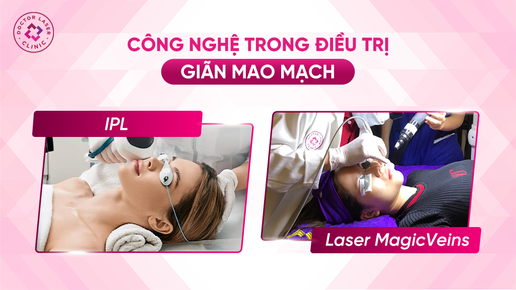 Bảng so sánh công nghệ IPL và Laser trong điều trị giãn mao mạch