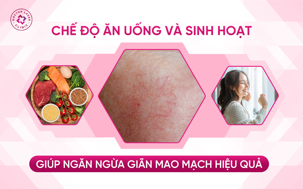 Chế độ ăn uống và sinh hoạt giúp ngăn ngừa giãn mao mạch hiệu quả