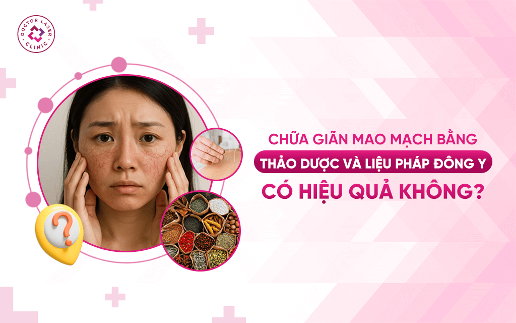 Chữa giãn mao mạch bằng thảo dược và liệu pháp Đông y