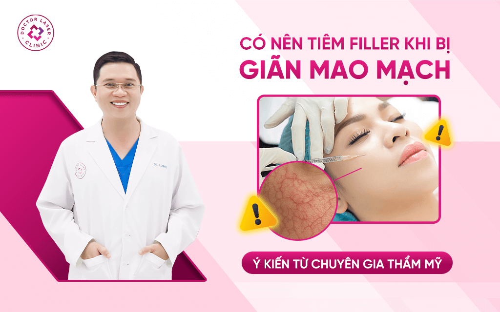Có nên tiêm filler khi bị giãn mao mạch? Ý kiến từ chuyên gia thẩm mỹ