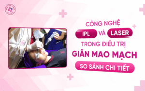 Công nghệ IPL và Laser trong điều trị giãn mao mạch Công nghệ IPL và Laser trong điều trị giãn mao mạch
