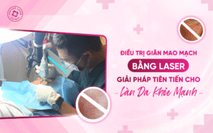 Điều trị giãn mao mạch bằng Laser Điều trị giãn mao mạch bằng Laser