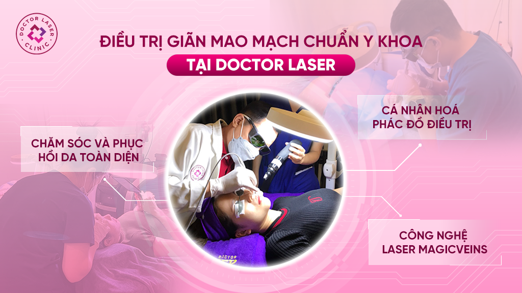 Điều trị giãn mao mạch chuẩn y khoa tại Doctor Laser