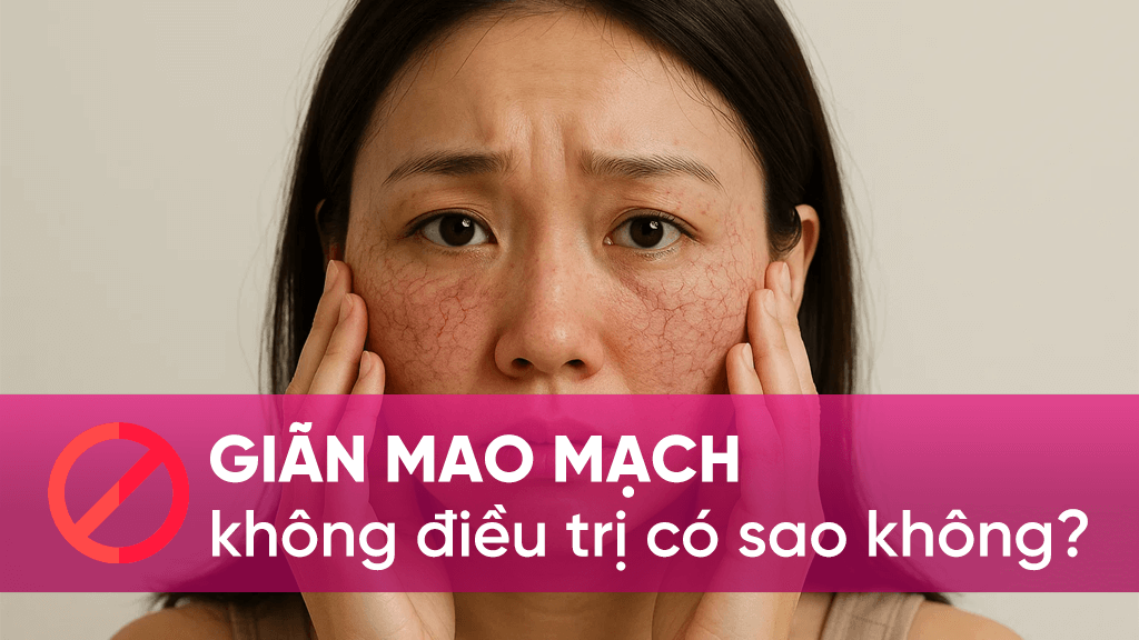 Tác hại của giãn mao mạch nếu không điều trị
