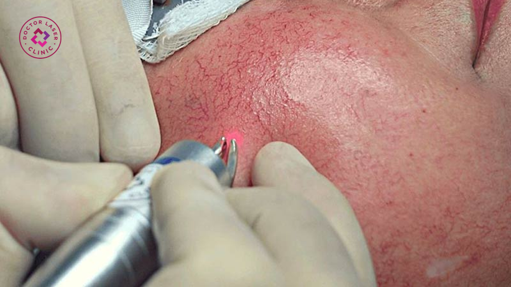 Lịch sử và quá trình ứng dụng laser trong y học