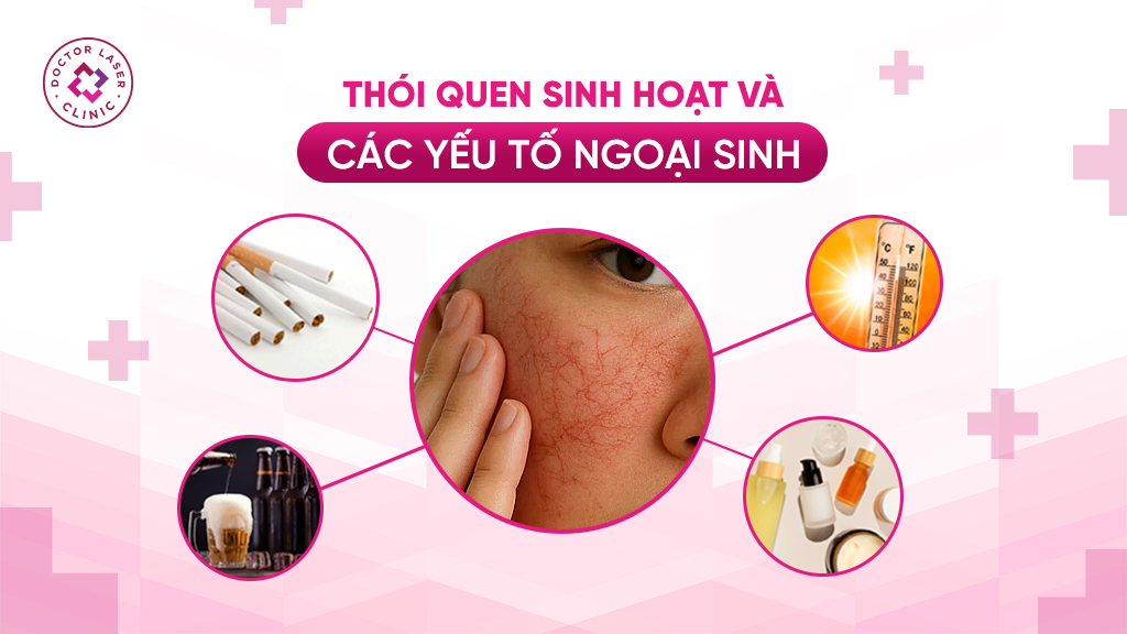 Giãn mao mạch do thói quen sinh hoạt và các yếu tố ngoại sinh