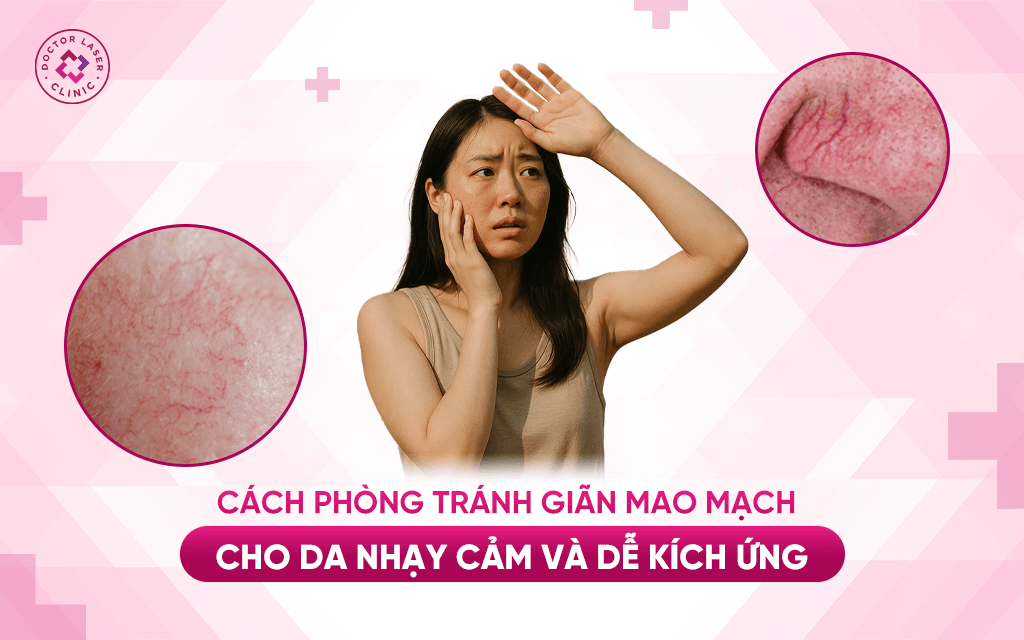 Biện pháp phòng tránh giãn mao mạch cho da nhạy cảm và dễ kích ứng