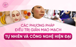 Các phương pháp điều trị giãn mao mạch_ Tự nhiên và công nghệ hiện đại