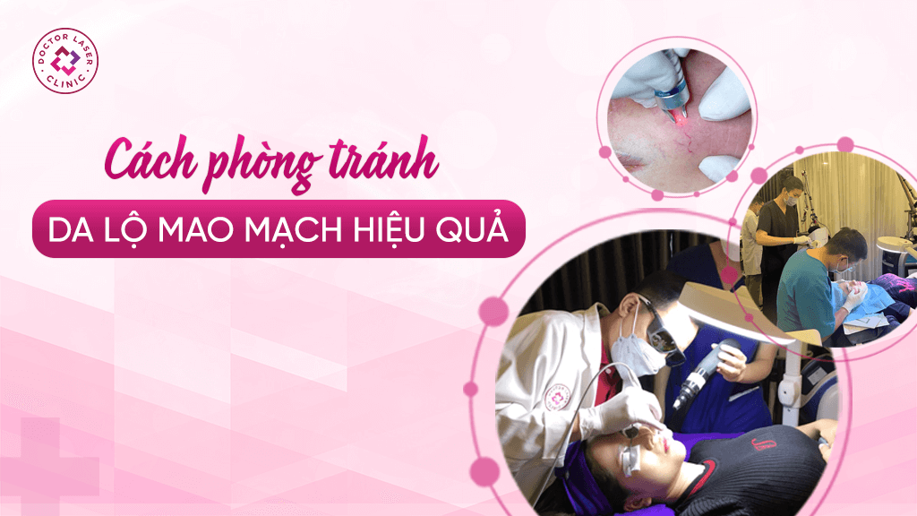 Điều trị và phòng tránh da lộ mao mạch bằng công nghệ laser tại phòng khám