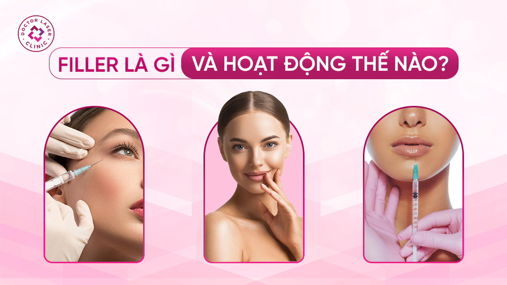 Filler là gì và hoạt động thế nào