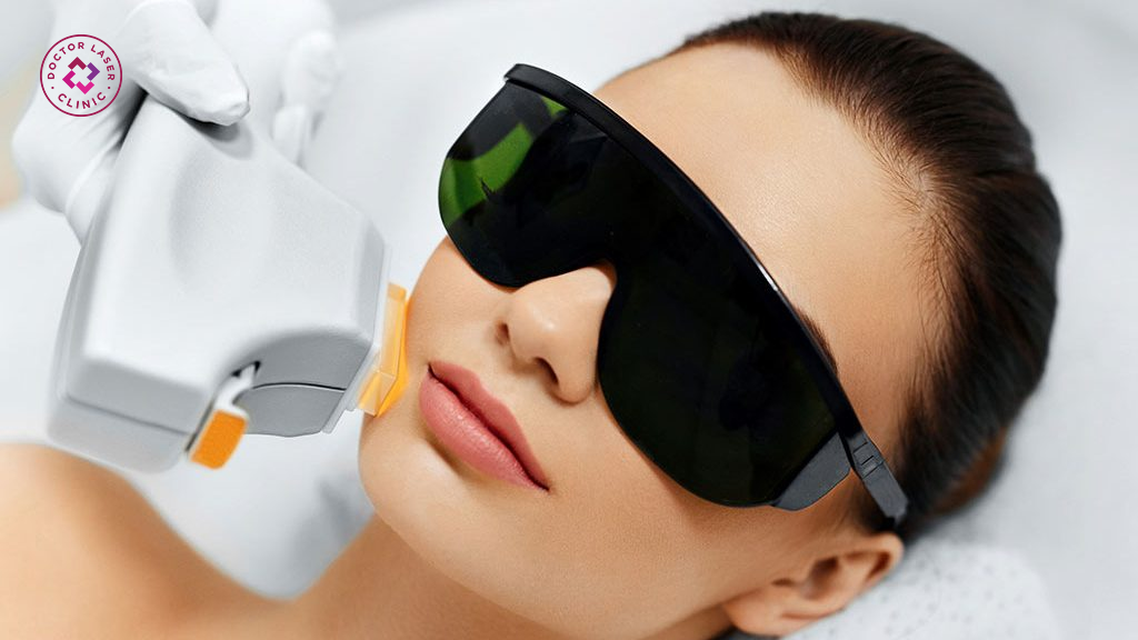 Công nghệ IPL trong điều trị giãn mao mạch