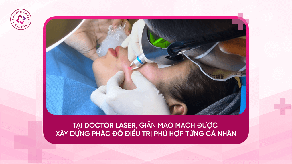 Điều trị giãn mao mạch tại Doctor Laser