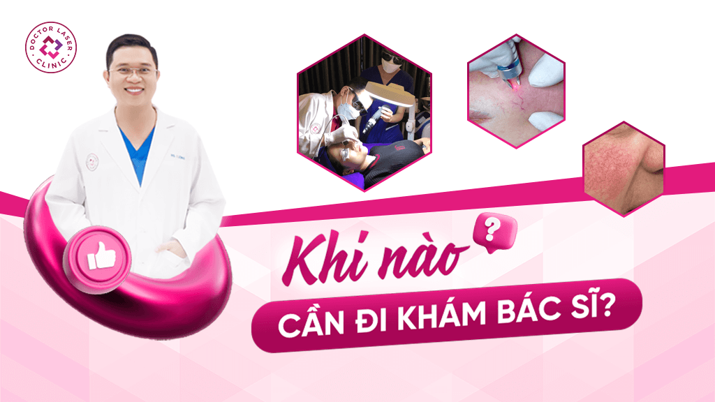 Giãn mao mạch khi nào cần đi khám bác sĩ