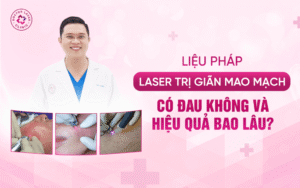 Liệu pháp laser trị giãn mao mạch Có đau không và hiệu quả bao lâu