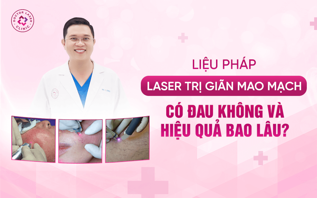 Liệu pháp laser trị giãn mao mạch Có đau không và hiệu quả bao lâu