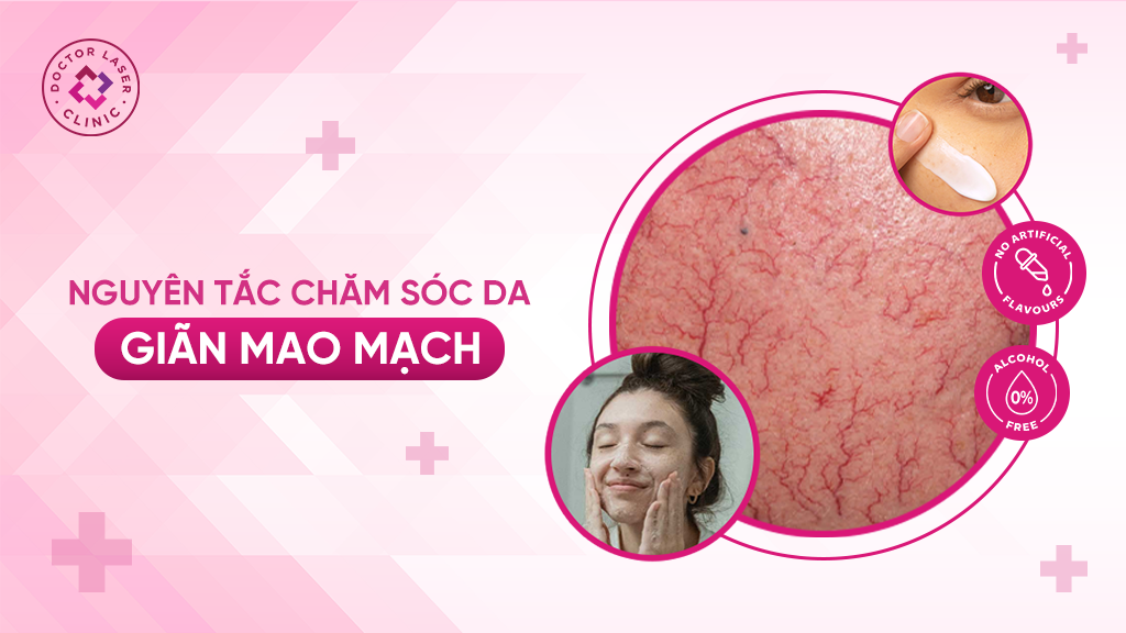 Nguyên tắc chăm sóc da nhạy cảm bị giãn mao mạch