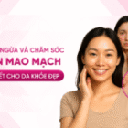 Phòng ngừa và chăm sóc giãn mao mạch: 4 Bí quyết cho da khỏe đẹp