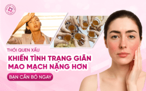 Thói quen xấu khiến tình trạng giãn mao mạch nặng hơn