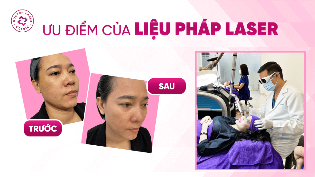 Hình ảnh trước & sau khi sử dụng liệu pháp Laser tại Doctor Laser