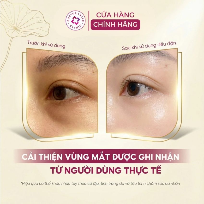 ket-qua-giam-bong-mat-sau-khi-su-dung-eyelift-serum Serum trị thâm mắt Dr. Clariv dưỡng sáng vùng mắt 20ml - Ảnh 5