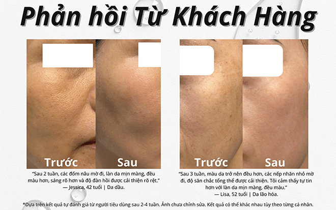kết quả sử dụng serum trẻ hoá da elixir blanc