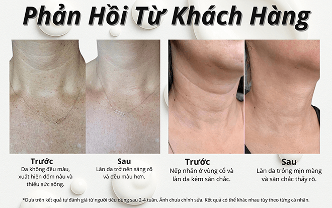 phản hồi khách hàng kem dưỡng vùng cổ drclariv