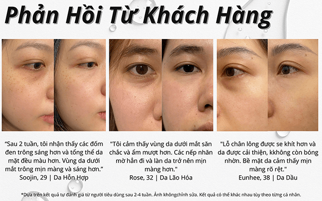 phản hồi khách hàng serum dưỡng mắt drclariv