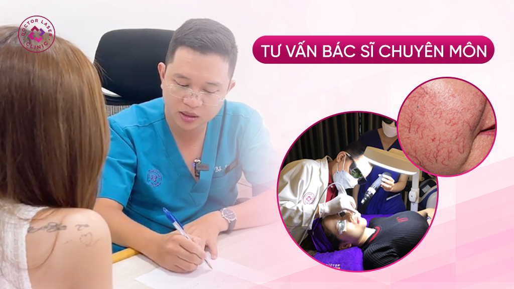 Tư vấn bác sĩ chuyên môn điều trị giãn mao mạch
