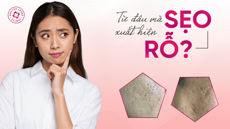 Từ đâu mà xuất hiện sẹo rỗ