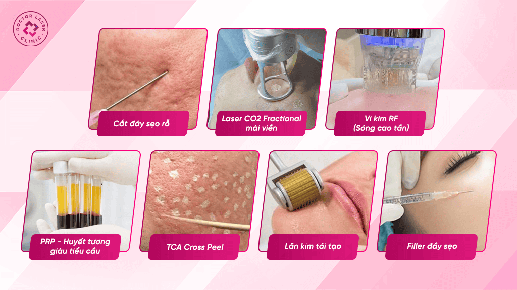 Các công nghệ điều trị sẹo