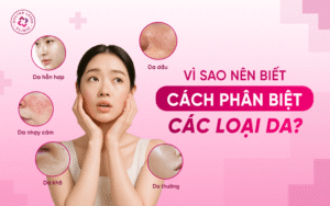 cach-phan-biet-loai-da