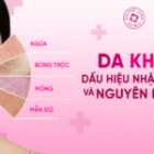 Da Khô Thiếu Nước? 5 Mẹo Dưỡng Ẩm Và Bảo Vệ Hàng Rào Da