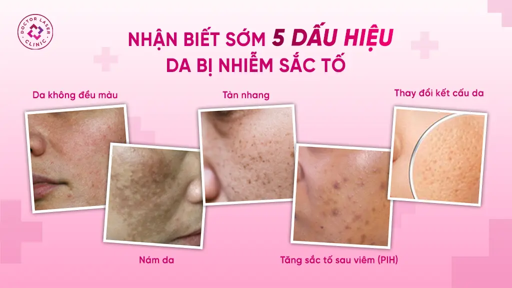 Dấu hiệu nhận biết trên bề mặt da