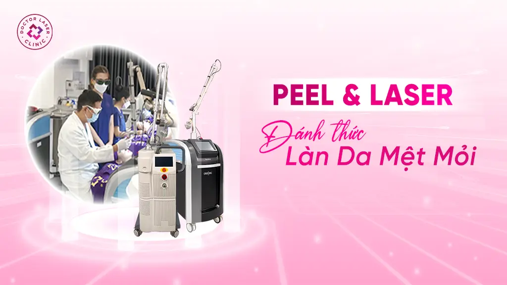 Liệu trình peel da laser pico laser co2