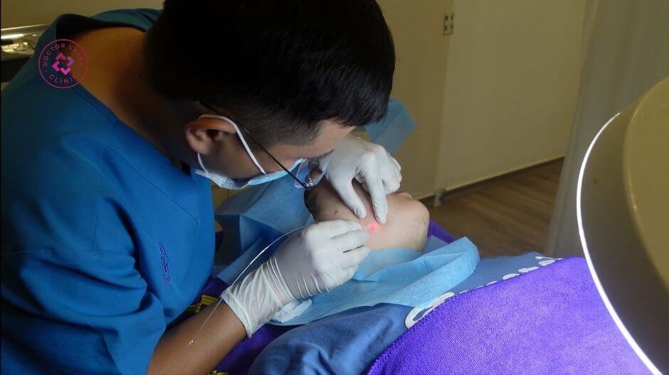 bác sĩ đang thực hiện laserlift