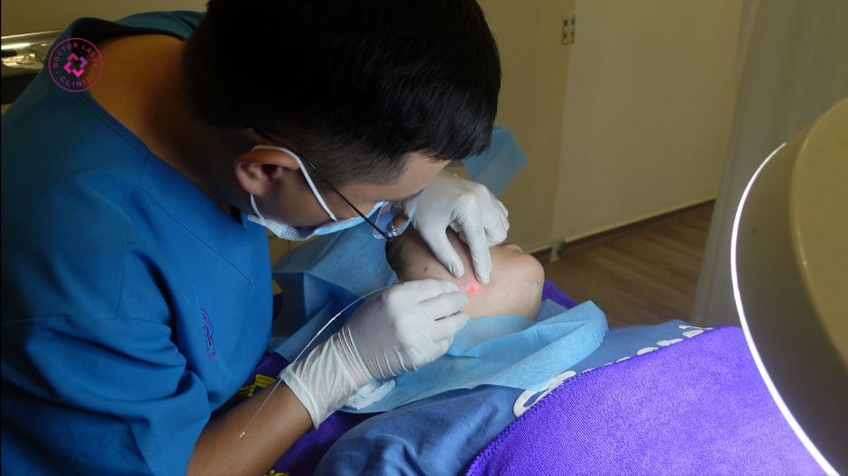 bác sĩ thực hiện laserlift 1330