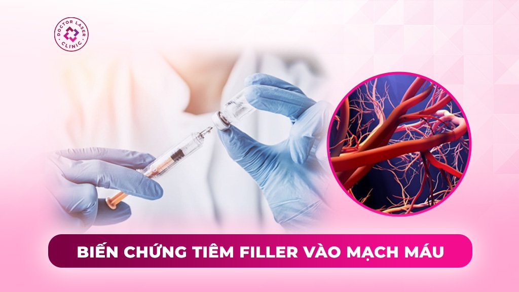 biến chứng tiêm filler vào mạch máu