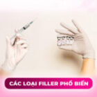 Các loại filler phổ biến trên thị trường được cấp phép sử dụng