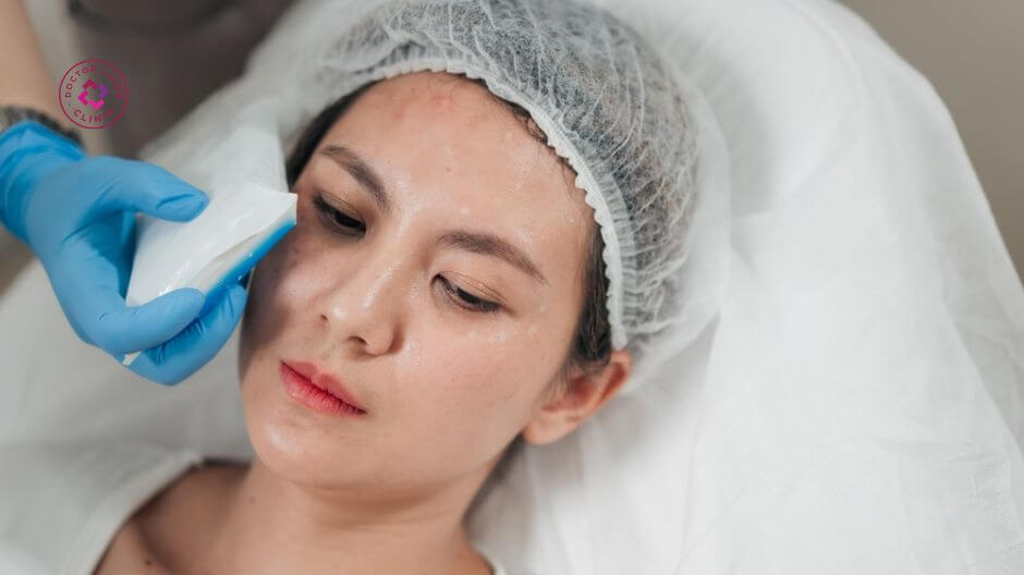 chườm lạnh sau tiêm filler má baby giảm sưng