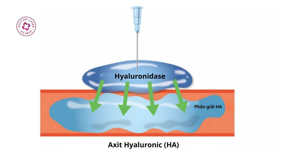 cơ chế hyaluronidase tiêm tan filler