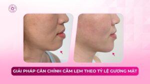 giải pháp cân chỉnh cằm lẹm theo tỷ lệ gương mặt