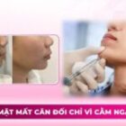 Gương mặt mất cân đối chỉ vì cằm ngắn – lẹm