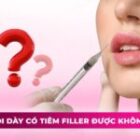 Thắc mắc: Môi dày có tiêm filler được không?