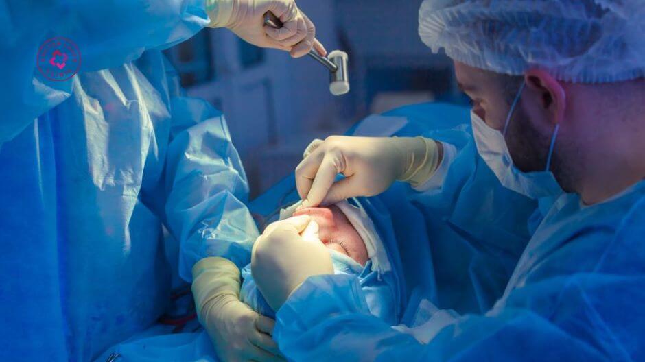 phẫu thuật xử lý filler trường hợp nặng