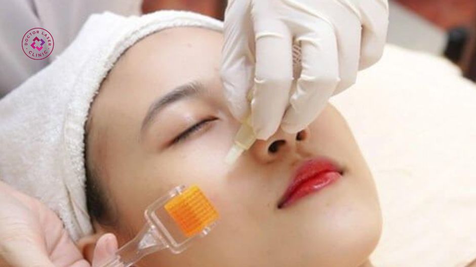 phương pháp lăn kim