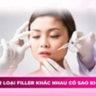 Tiêm 2 loại filler khác nhau có sao không? Những điều cần lưu ý