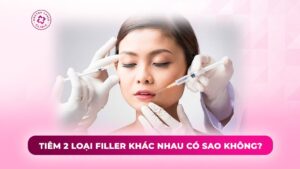 tiêm 2 loại filler khác nhau có sao không tiêm 2 loại filler khác nhau có sao không