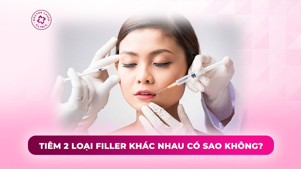 tiêm 2 loại filler khác nhau có sao không