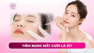 tiêm bọng mắt là gì tiêm bọng mắt là gì